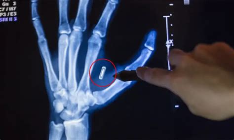 how to destroy rfid chip in body at home|How would one damage or deactivate an implanted microchip .